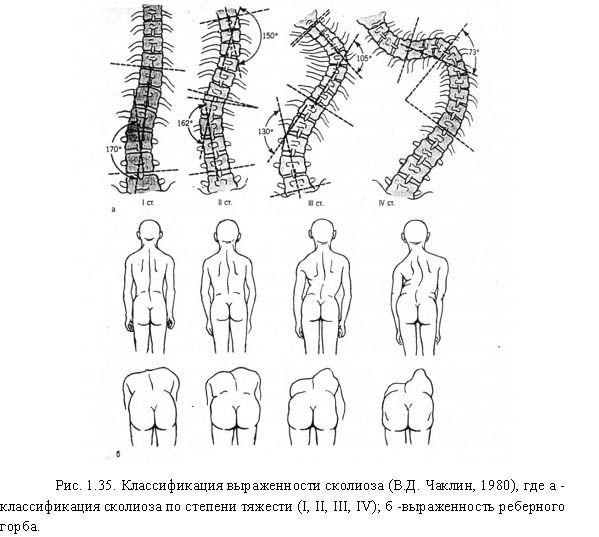 классификация по чаклину